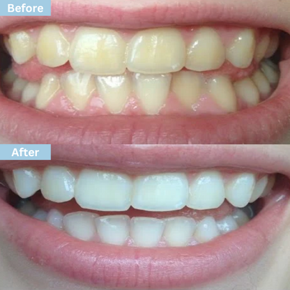 Glowflora Probiotic Smile Toothpaste