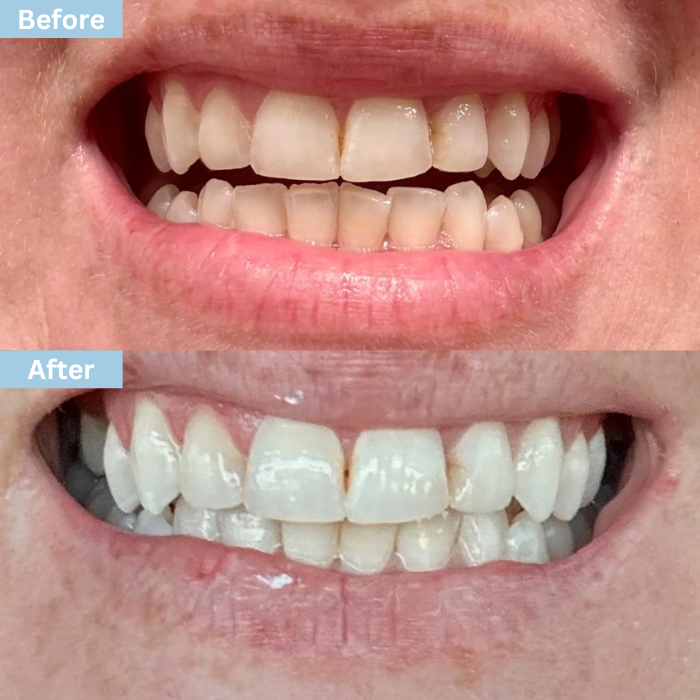 Glowflora Probiotic Smile Toothpaste